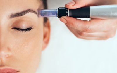 Mezoterapia mikroigłowa skóry twarzy – jak przygotować się do zabiegu?